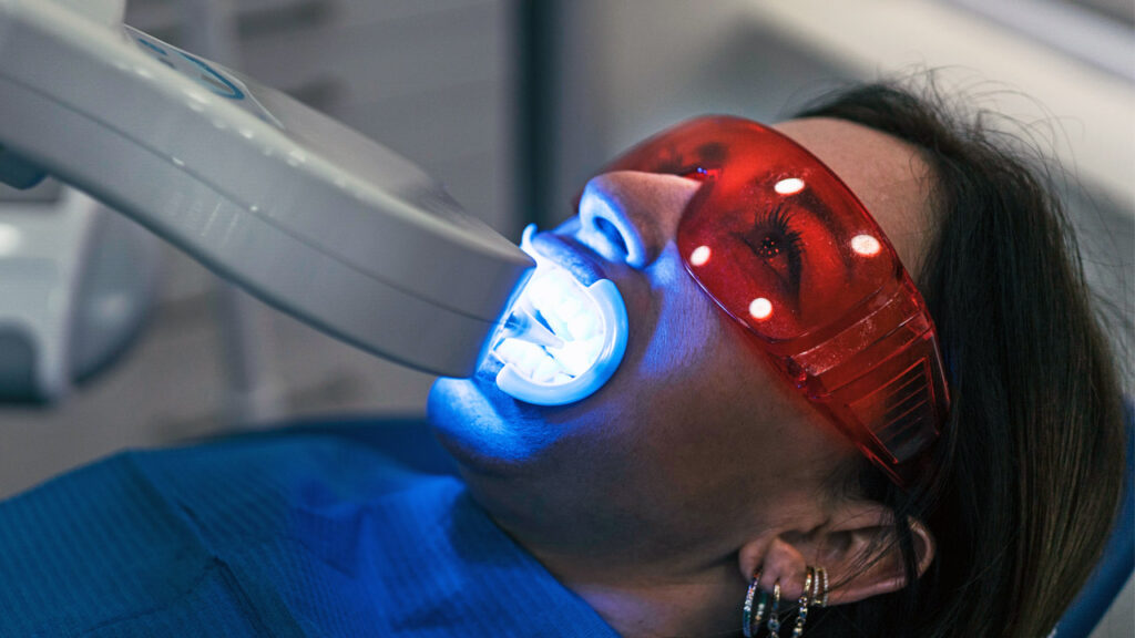 Does Blue Light Actually Whiten Teeth?